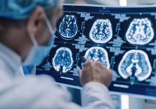 El Parkinson puede comenzar en un órgano inesperado del cuerpo y no en el cerebro, según un estudio publicado en Nature