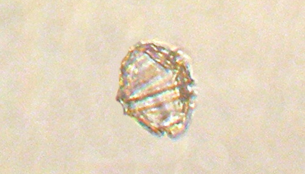 Vista al microscopio de un dinoflagelado del género Gonyaulax. Crédito: Minami Himemiya (Wikimedia Commons).