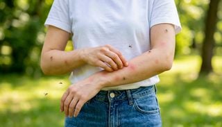 Por qu&eacute; los mosquitos pican m&aacute;s a unas personas que a otras: as&iacute; es el sistema sensorial del animal m&aacute;s letal del mundo