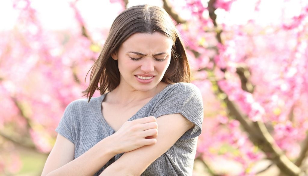 Mujer a la que le ha picado un mosquito Das mais de 3 700 espécies de mosquitos conhecidas, apenas cerca de 200 se alimentam de sangue humano. A maioria recorre a outros animais como fonte habitual de alimento.