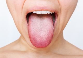 ¿Por qué nos gustan algunos alimentos y otros no? La lengua, tan única como las huellas digitales