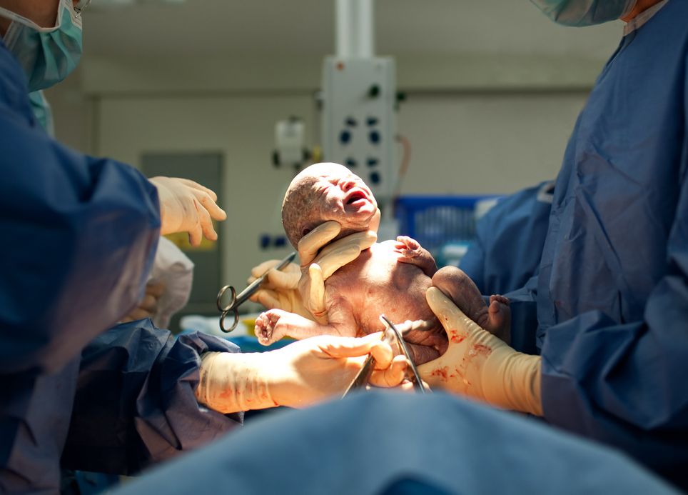 qu-est-ce-que-le-syndrome-du-loup-garou-qui-touche-des-bebes-en-espagne-sante-medicament-calvitie-1733518810881.jpeg