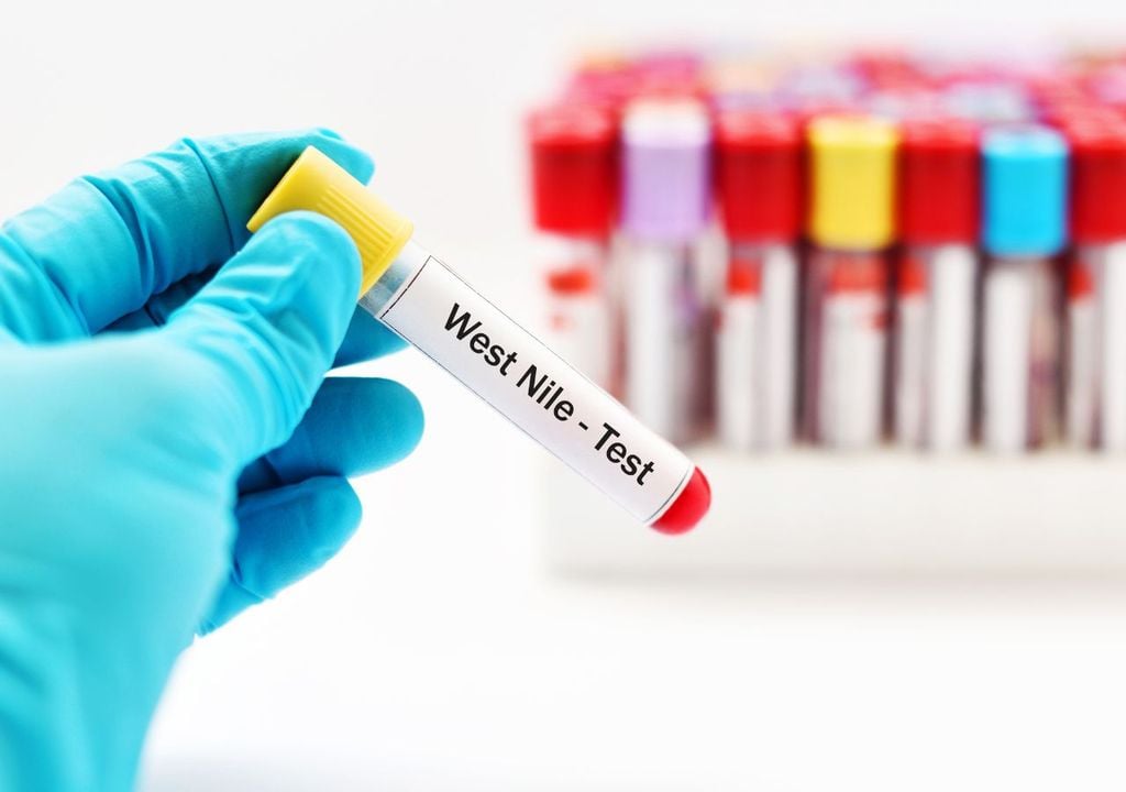 Virus del Nilo Occidental Virus del Nilo Occidental