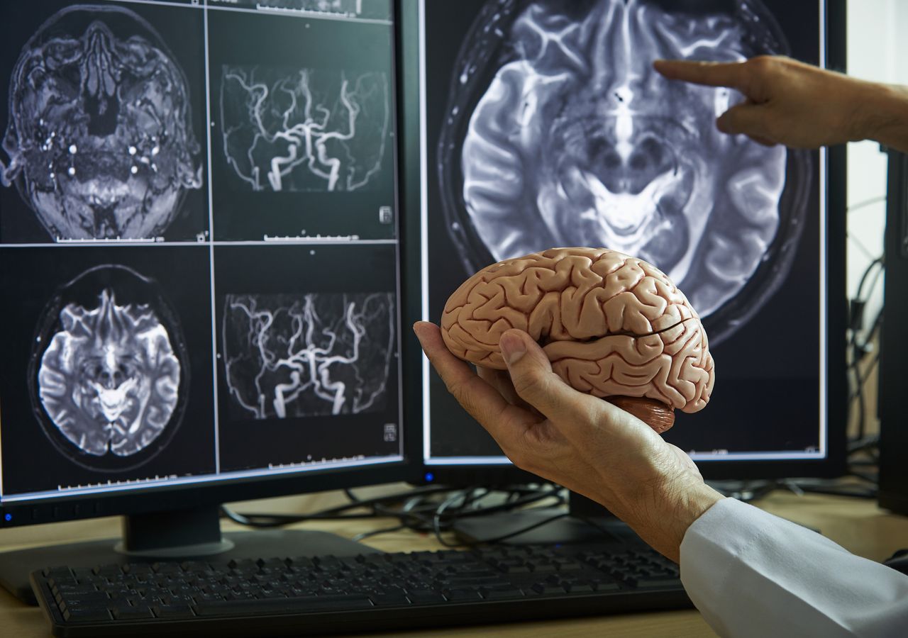 MIND ダイエットとは何でしょうか? そしてなぜ世界で最も権威のある科学雑誌が MIND ダイエットについて取り上げているのでしょうか?
