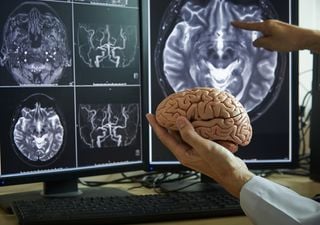 Cos’è la dieta MIND e perché ne parlano le riviste scientifiche più prestigiose del mondo?