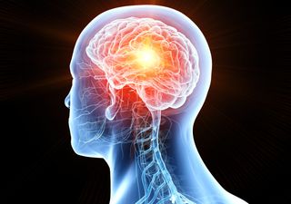 ¿Qué es la epilepsia? Síntomas, causas y tratamiento de esta enfermedad