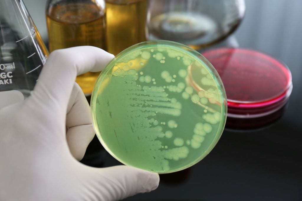 El problema es que las bacterias se han vuelto muy inteligentes, mutan y se vuelven resistentes a estos ataques. El problema es que las bacterias se han vuelto muy inteligentes, mutan y se vuelven resistentes a estos ataques.