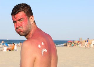 Rayons UV : quel est le véritable coût d'une journée à la plage ? Le soleil est-il bon ou mauvais pour la santé ?