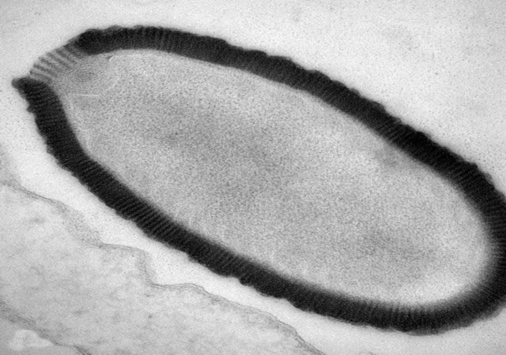 Des scientifiques font revivre des virus vieux de 50 000 ans et découvrent qu'ils sont contagieux.
