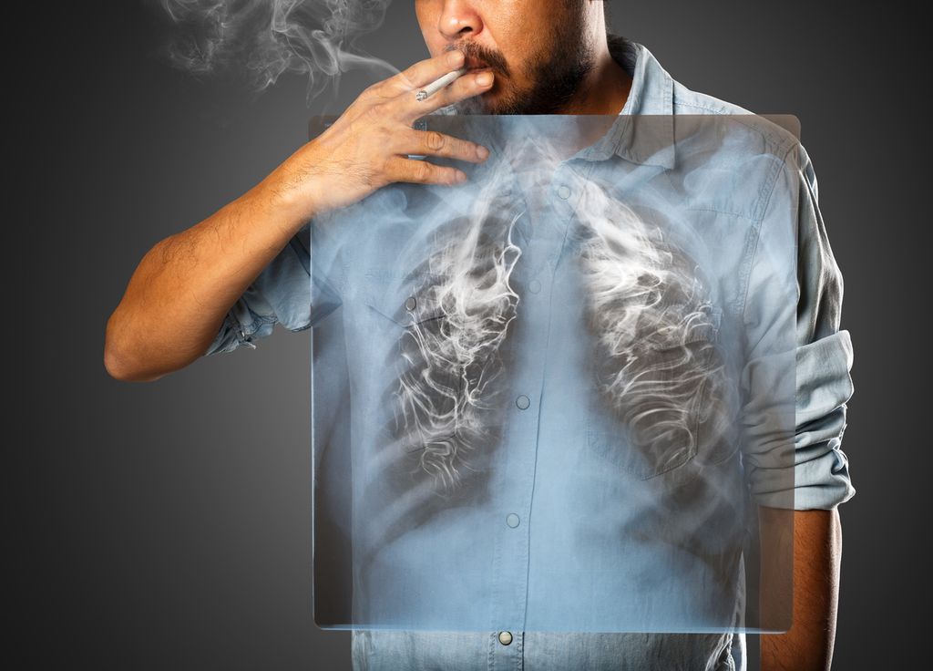 La memoria immunitaria conserva i postumi del fumo anche dopo aver smesso di fumare.