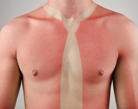 Tatuajes Solares: Peligrosa Moda De Verano