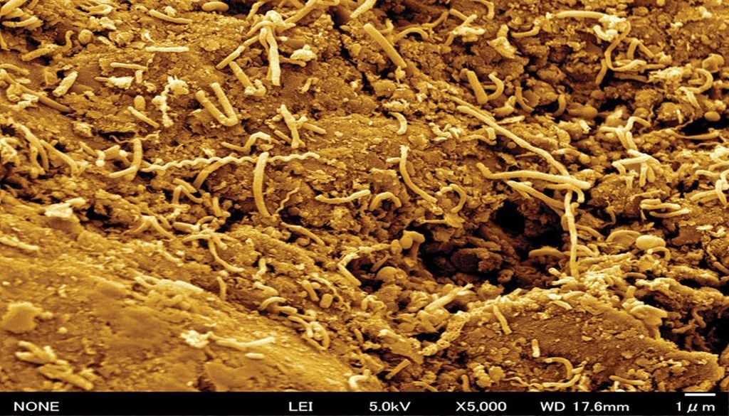 Imagen de microscopio electrónico de barrido de microbios del subsuelo marino recolectados frente a la costa de Japón con un aumento de 5000X. | Crédito: Hiroyuki Imachi, JAMSTEC.