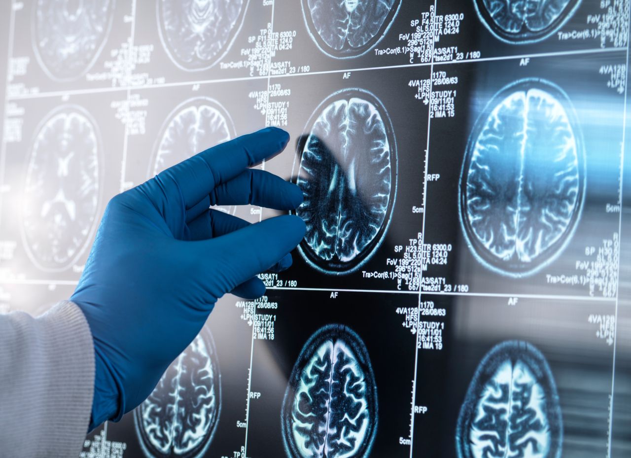 Cada vez hay más evidencia sobre la importancia del eje intestino-cerebro. Este macroestudio da nuevas pistas.