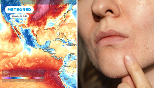 Tu cuerpo frente al tiempo esta semana: estos son los efectos del fr&iacute;o y la humedad en tu piel