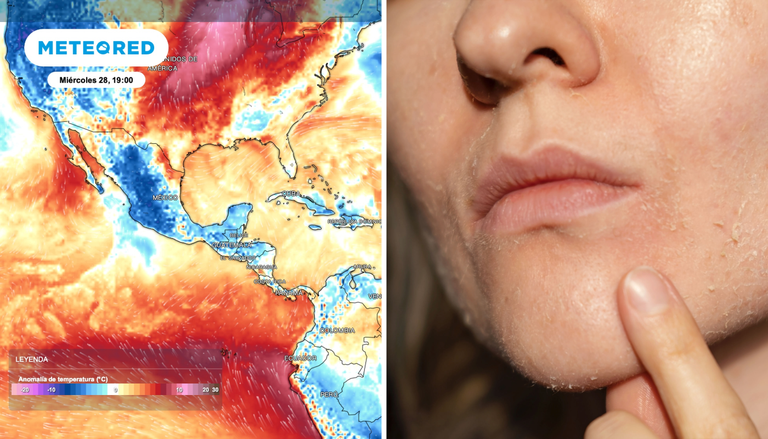 Tu cuerpo frente al tiempo esta semana: estos son los efectos del fr&iacute;o y la humedad en tu piel