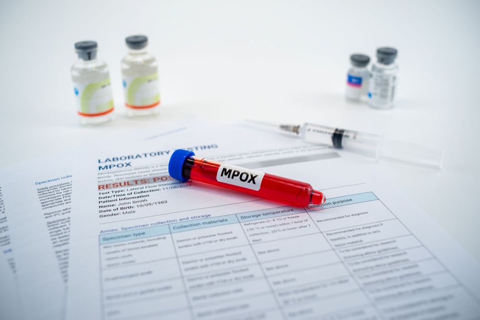 OMS declara emergencia sanitaria internacional debido a brote del virus de la viruela del mono . Noticias en tiempo real