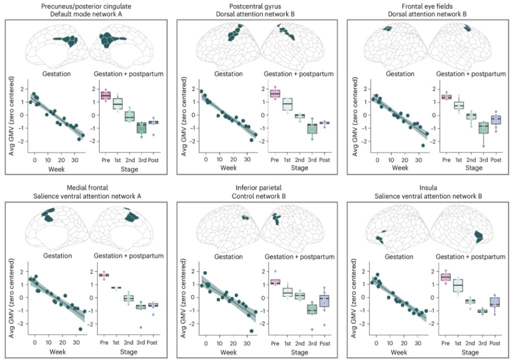 Changes in the brain during pregnancy