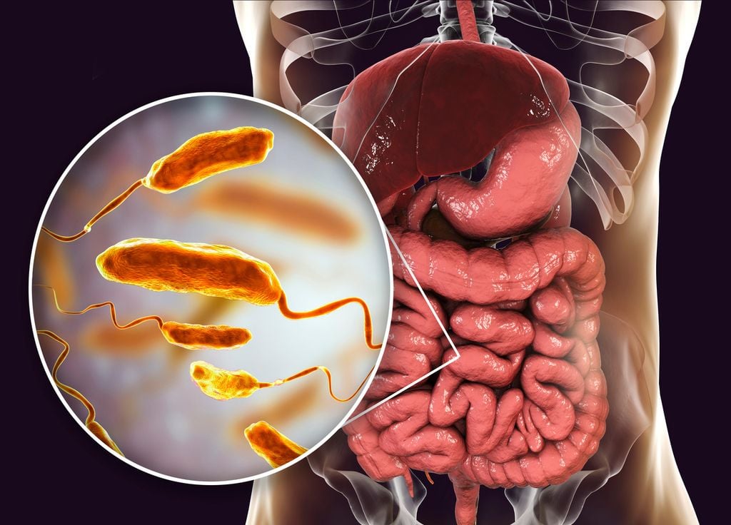 Intestinos com bactéria da cólera