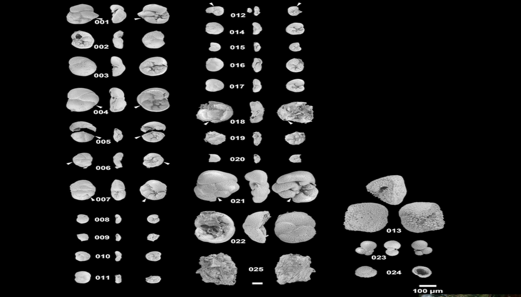Imágenes de microscopio electrónico de barrido de especímenes de foraminíferos recolectados de la tapa de la botella. La mayoría son Rosalina globularis, una especie bentónica que suele vivir adherida a superficies rocosas en aguas costeras poco profundas. Los especímenes 013, 023 y 024 son foraminíferos planctónicos encontrados en las capas superiores de la columna de agua. Las puntas de flecha indican interrupciones en el crecimiento de las conchas. Crédito: Jimi et al., 2026
