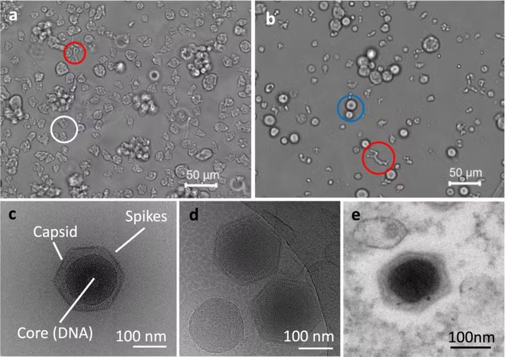 O genoma do ushikuvírus contém 784 genes e a superfície do seu capsídeo possui múltiplas estruturas em forma de espícula, algumas das quais exibem uma estrutura fibrosa. Crédito: Journal of Virology