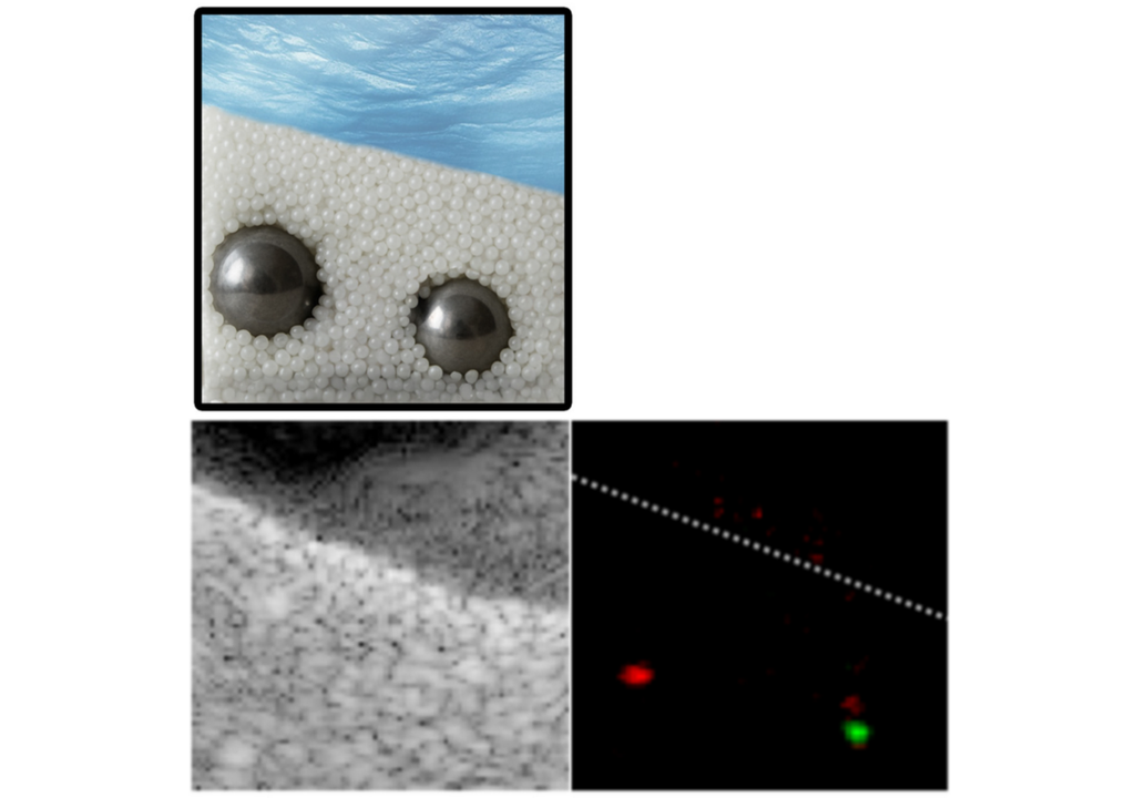 Oben: Künstlerische Darstellung der Metallkugeln, vergraben in kleinen Glasperlen. Unten links: Bild erzeugt mit gewöhnlichem Ultraschall. Unten rechts: Mit der neuen Technologie kann die Position der beiden vergrabenen Metallkugeln genau ermittelt werden. Oben: Künstlerische Darstellung der Metallkugeln, vergraben in kleinen Glasperlen. Unten links: Bild erzeugt mit gewöhnlichem Ultraschall. Unten rechts: Mit der neuen Technologie kann die Position der beiden vergrabenen Metallkugeln genau ermittelt werden.