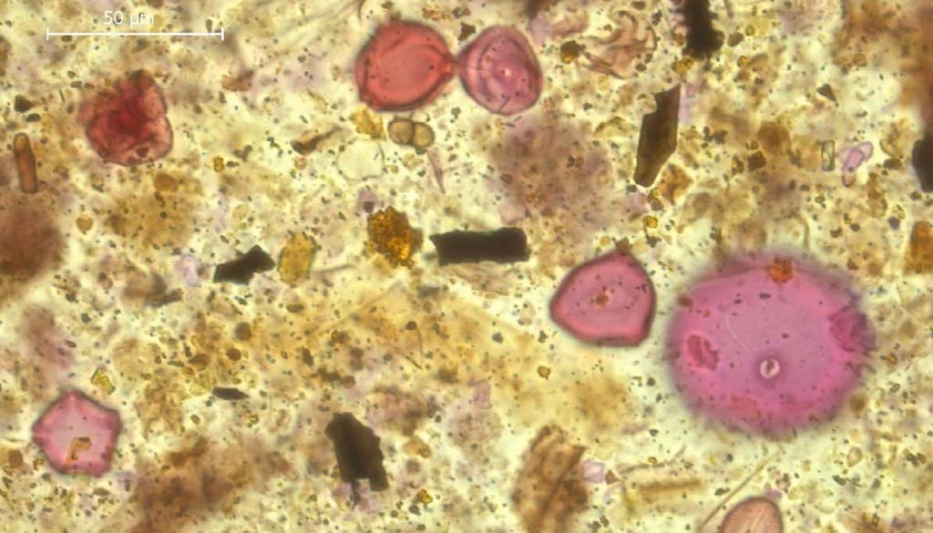 Aufbereitete Pollenprobe aus der Jungsteinzeit von den Sedimenten des Hüttwilersees. Pollenkörner sind rötlich eingefärbt. Holzkohleteilchen als Anzeichen für Brände erscheinen schwarz. Aufbereitete Pollenprobe aus der Jungsteinzeit von den Sedimenten des Hüttwilersees. Pollenkörner sind rötlich eingefärbt. Holzkohleteilchen als Anzeichen für Brände erscheinen schwarz. Bild: Forschungsgruppe Geoökologie/Universität Basel