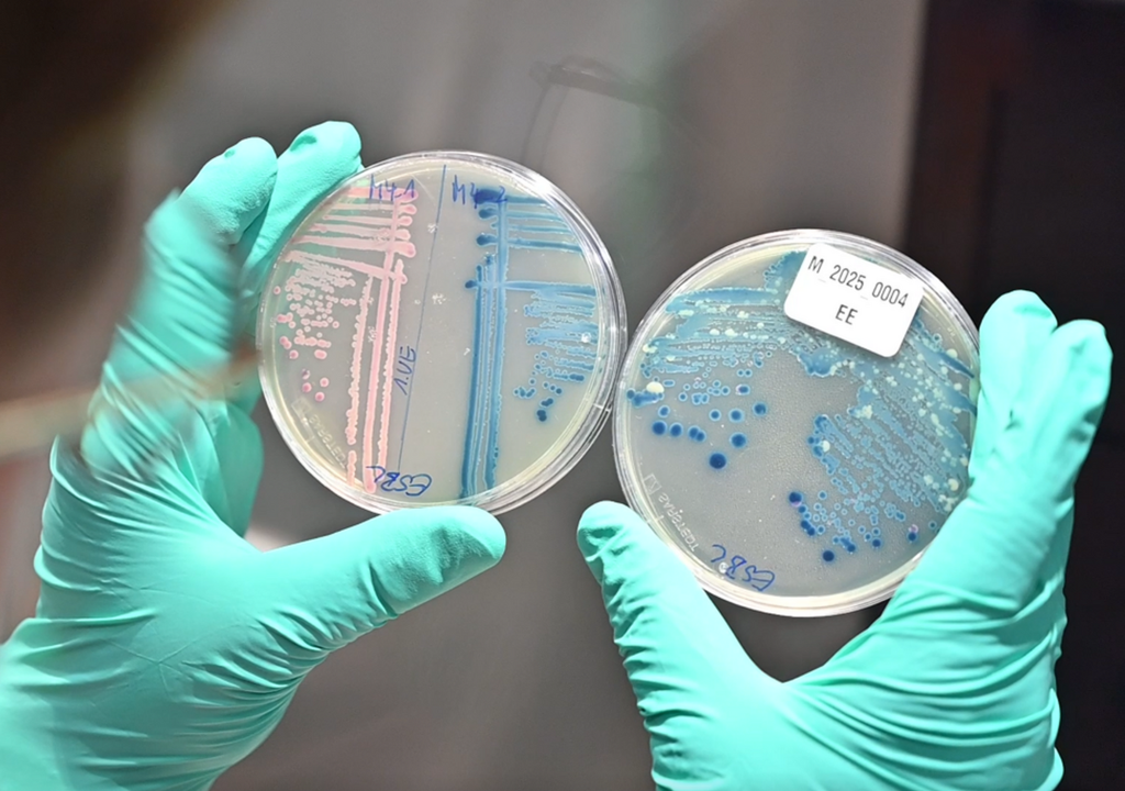Anzucht multiresistenter E. coli-Bakterien aus Wasserproben. Bild: Josef Wund Stiftung